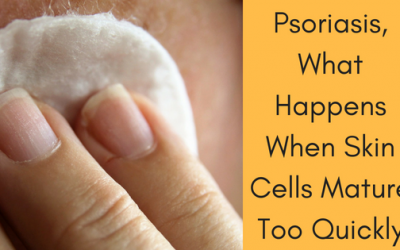 Psoriasis, What Happens When Skin Cells Mature Too Quickly