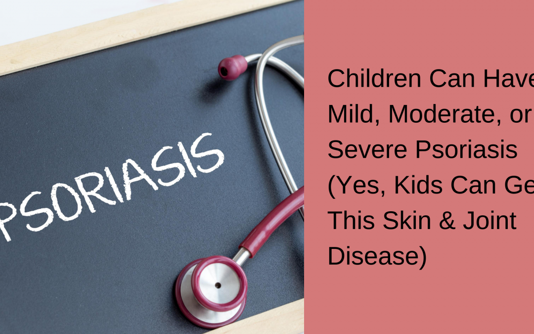 Children Can Have Mild, Moderate, or Severe Psoriasis (Yes, Kids Can Get This Skin & Joint Disease)